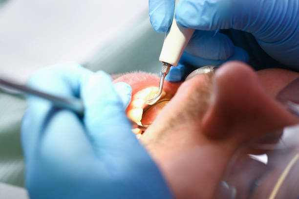 Best Broken or Cracked Tooth Emergency Dentist in Ionia, MI