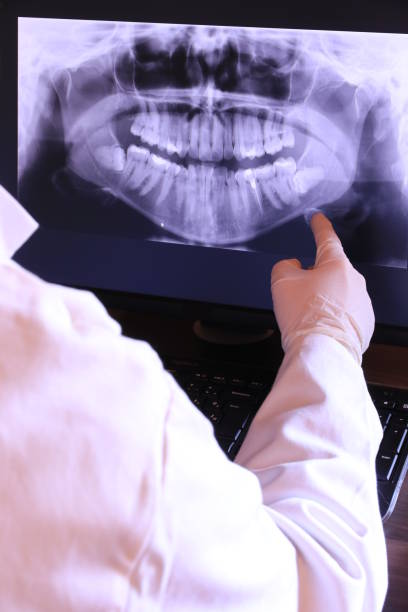 Best Broken or Cracked Tooth Emergency Dentist in Ionia, MI